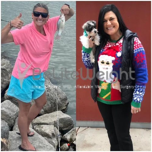 Weight Loss Surgery Mini Gastric Bypass Before and After Jentry J - 16 Month Update*